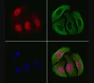 Anti-Chk2 (phospho Thr68) antibody used in Immunocytochemistry/ Immunofluorescence (ICC/IF). GTX03351