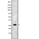 Anti-TMEM106C antibody used in Western Blot (WB). GTX03354