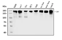 Anti-TJP2 antibody used in Western Blot (WB). GTX03355