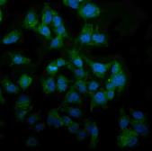 Anti-MAP3K8 antibody used in Immunocytochemistry/ Immunofluorescence (ICC/IF). GTX03357