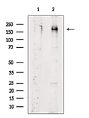 Anti-Her2 / ErbB2 (phospho Tyr1248) antibody used in Western Blot (WB). GTX03358