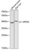 Anti-GPR55 antibody used in Western Blot (WB). GTX03363