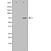Anti-HDC antibody used in Western Blot (WB). GTX03370