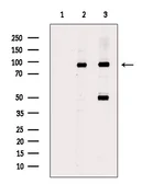 Anti-FOXO1 (Acetyl Lys294) antibody used in Western Blot (WB). GTX03372