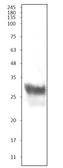 Anti-CD8 alpha antibody used in Western Blot (WB). GTX03377