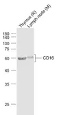 Anti-CD16a antibody used in Western Blot (WB). GTX03380