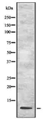Anti-UFM1 antibody used in Western Blot (WB). GTX03387