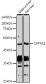 Anti-CYP7A1 antibody used in Western Blot (WB). GTX03391