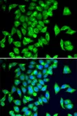 Anti-TPH2 antibody used in Immunocytochemistry/ Immunofluorescence (ICC/IF). GTX03395