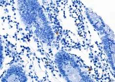 Anti-LAT1 / SLC7A5 antibody used in IHC (Paraffin sections) (IHC-P). GTX03401