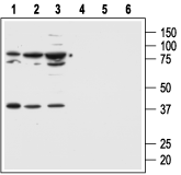 Anti-MC1 Receptor antibody used in Western Blot (WB). GTX03405