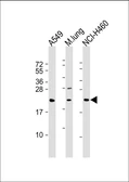 Anti-TUSC1 antibody used in Western Blot (WB). GTX03411