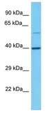 Anti-SIAT4A antibody used in Western Blot (WB). GTX03412