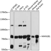 Anti-MAN1B1 antibody used in Western Blot (WB). GTX03414