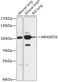 Anti-SGEF antibody used in Western Blot (WB). GTX03416