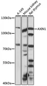 Anti-AXIN1 antibody used in Western Blot (WB). GTX03417