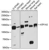 Anti-ATP1A2 antibody used in Western Blot (WB). GTX03420