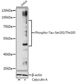 Anti-Tau (phospho Ser202/Thr205) antibody used in Western Blot (WB). GTX03423