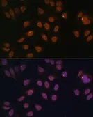 Anti-FOXG1 antibody used in Immunocytochemistry/ Immunofluorescence (ICC/IF). GTX03427