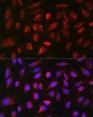 Anti-BMP7 antibody used in Immunocytochemistry/ Immunofluorescence (ICC/IF). GTX03429