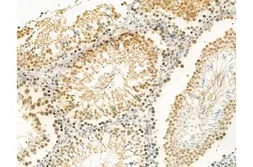 Anti-Ki67 (phospho Thr1335) antibody used in IHC (Paraffin sections) (IHC-P). GTX03435