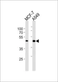 Anti-CCRK antibody [885CT27.1.1] used in Western Blot (WB). GTX03437