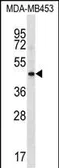 Anti-HAPLN3 antibody used in Western Blot (WB). GTX03438