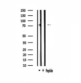 Anti-A-Myb antibody used in Western Blot (WB). GTX03441