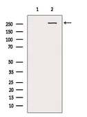 Anti-NG2 antibody used in Western Blot (WB). GTX03452
