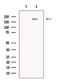 Anti-NOTCH4 antibody used in Western Blot (WB). GTX03453