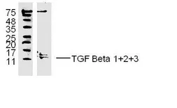 Anti-TGF beta antibody used in Western Blot (WB). GTX03464