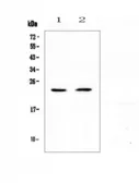 Anti-FNDC5 antibody used in Western Blot (WB). GTX03466