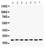 Anti-Lysozyme antibody used in Western Blot (WB). GTX03467