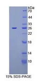 Human CA125 protein, His Tag. GTX03487-pro