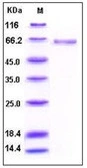 Human Alkaline Phosphatase (Tissue Non-Specific) protein, His tag (active). GTX03499-pro