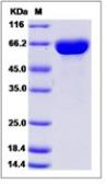 Human HEXB protein, His tag (active). GTX03539-pro