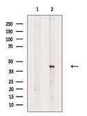 Anti-Doublecortin (phospho Ser335) antibody used in Western Blot (WB). GTX03587