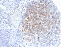 Anti-Interferon alpha 1 antibody [IFNA/6689] used in IHC (Paraffin sections) (IHC-P). GTX03591