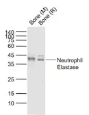 Anti-Neutrophil elastase antibody used in Western Blot (WB). GTX03641