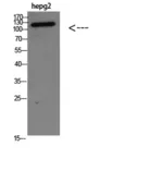 Anti-TERT antibody used in Western Blot (WB). GTX03646
