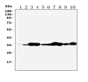 Anti-Annexin V antibody used in Western Blot (WB). GTX03658