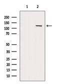 Anti-CD93 antibody used in Western Blot (WB). GTX03674