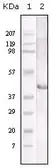 Anti-LAL antibody [9G7F12] used in Western Blot (WB). GTX03687