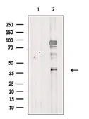 Anti-GPR25 antibody used in Western Blot (WB). GTX03691