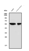 Anti-SGK1 antibody used in Western Blot (WB). GTX03696