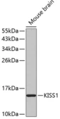 Anti-Kiss1 antibody used in Western Blot (WB). GTX03697