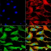 Anti-ATP7b antibody [S62-29] used in Immunocytochemistry/ Immunofluorescence (ICC/IF). GTX03698