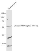 Anti-AMPK alpha 1 (phospho Thr183) + AMPK alpha 2 (phospho Thr172) antibody used in Western Blot (WB). GTX03702