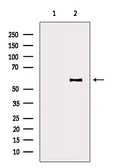 Anti-PRAME antibody used in Western Blot (WB). GTX03709