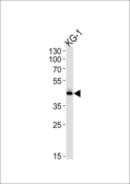 Anti-SIRT3 antibody used in Western Blot (WB). GTX03711